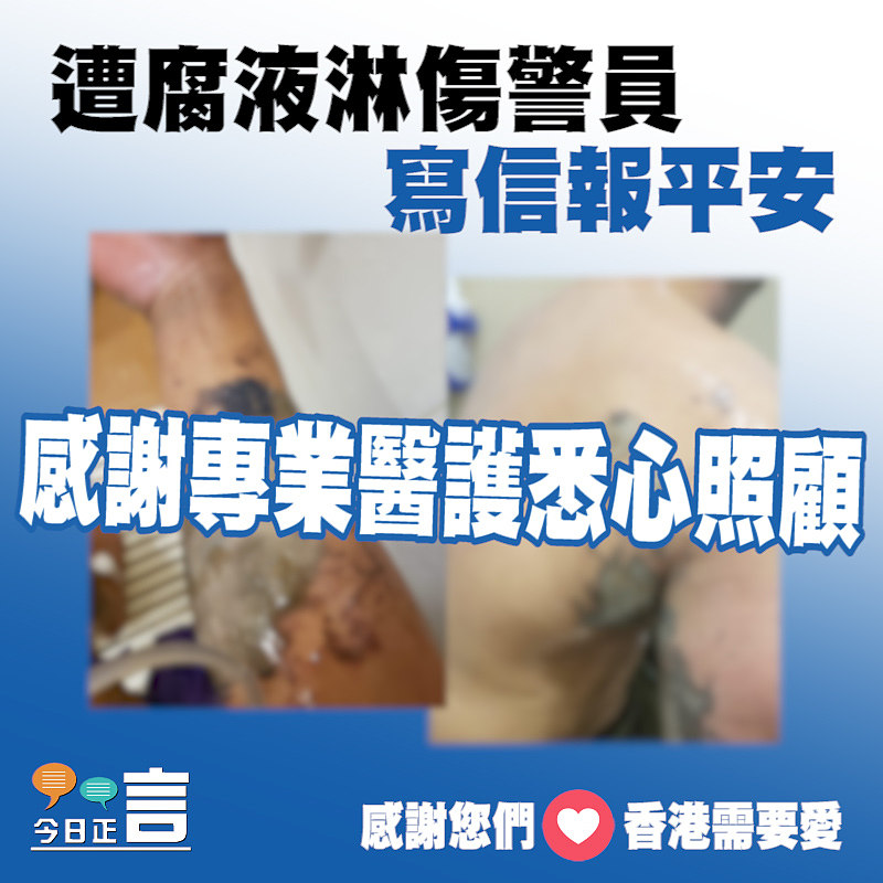 遭腐液淋傷警員寫信報平安 感謝專業醫護悉心照顧