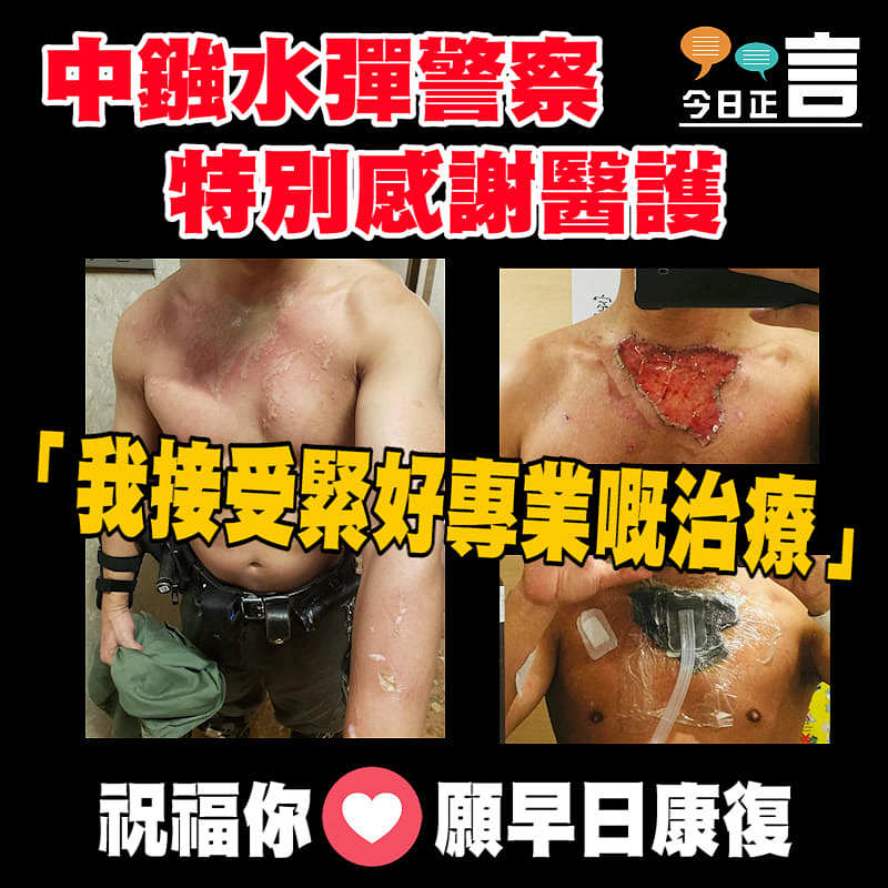 中鏹水彈警察特別感謝醫護 「我接受緊好專業嘅治療」