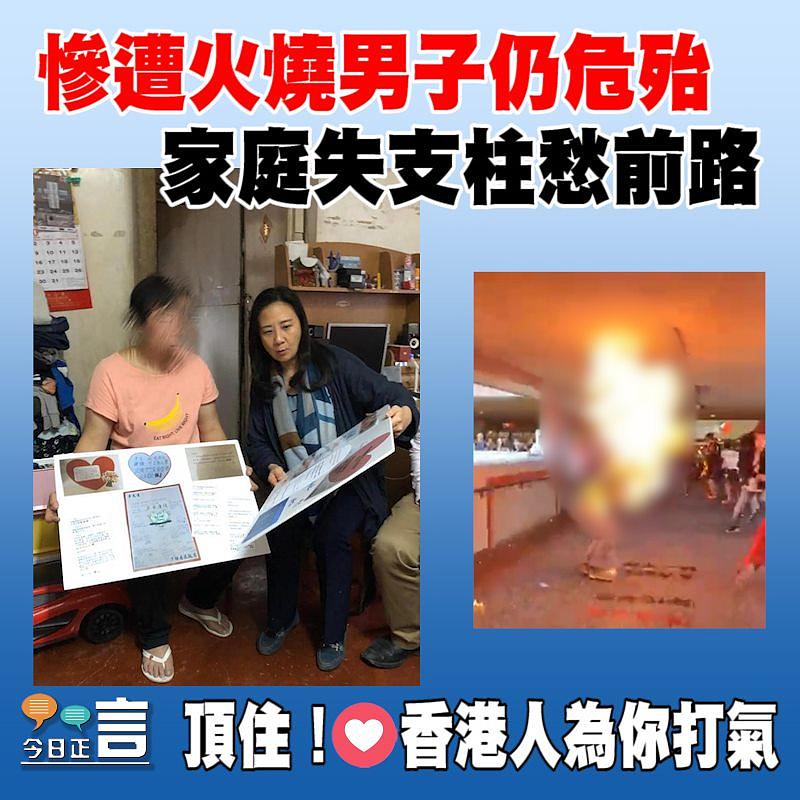 慘遭火燒男子仍危殆 家庭失支柱愁前路