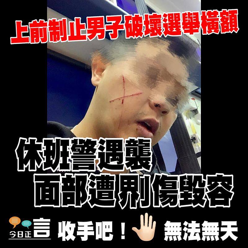 休班警遇襲 面部遭𠝹傷毀容