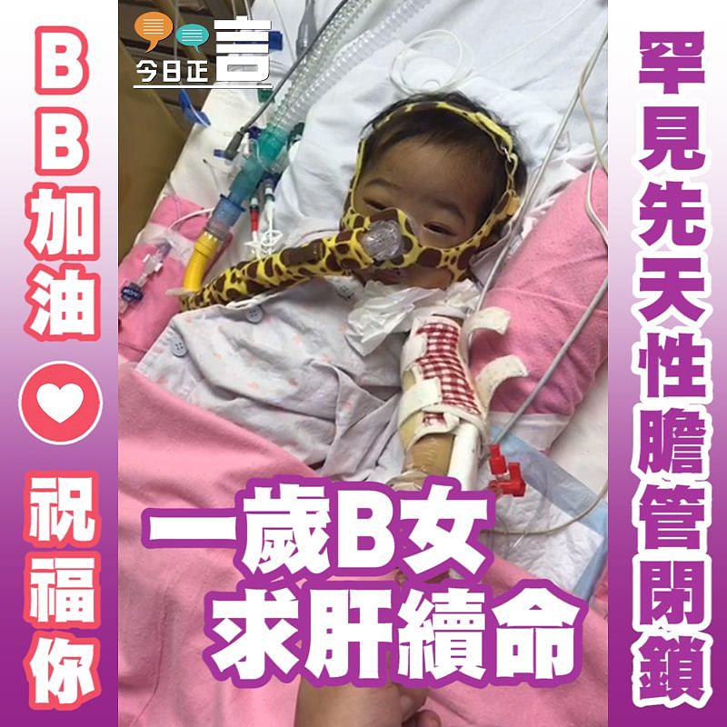 罕見先天性膽管閉鎖 一歲B女一歲B女