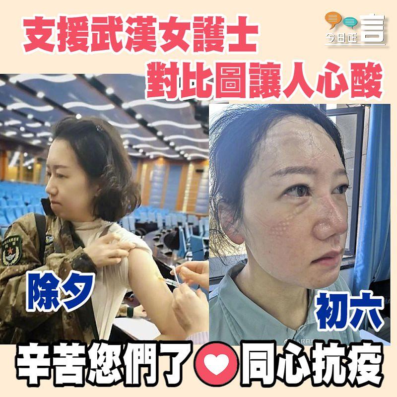 支援武漢女護士 對比圖讓人心酸