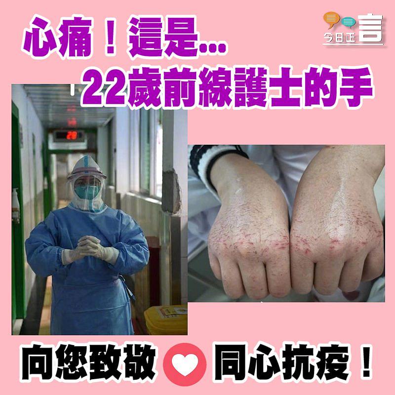 心痛！這是...22歲前線護士的手