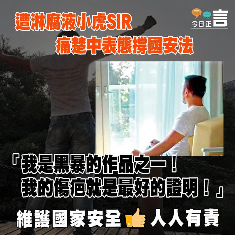 遭淋腐液小虎SIR 痛楚中表態撐國安法