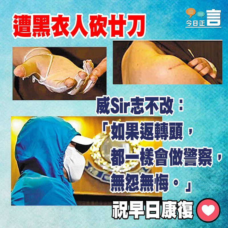 遭黑衣人砍廿刀 威Sir志不改：「如果返轉頭，都一樣會做警察」