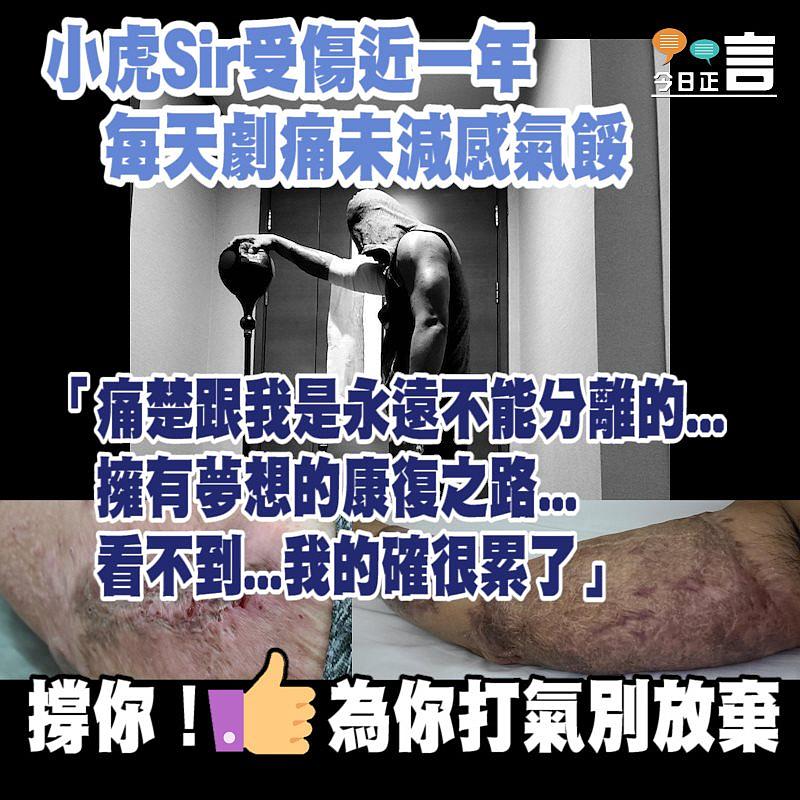 小虎Sir受傷近一年 每天劇痛未減感氣餒