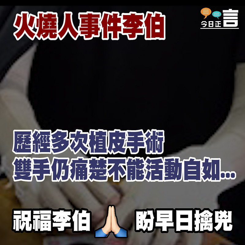 火燒人事件李伯歷經多次植皮手術雙手仍痛楚不能活動自如