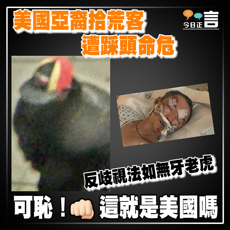 又一宗！美國亞裔拾荒客遭踩頭命危