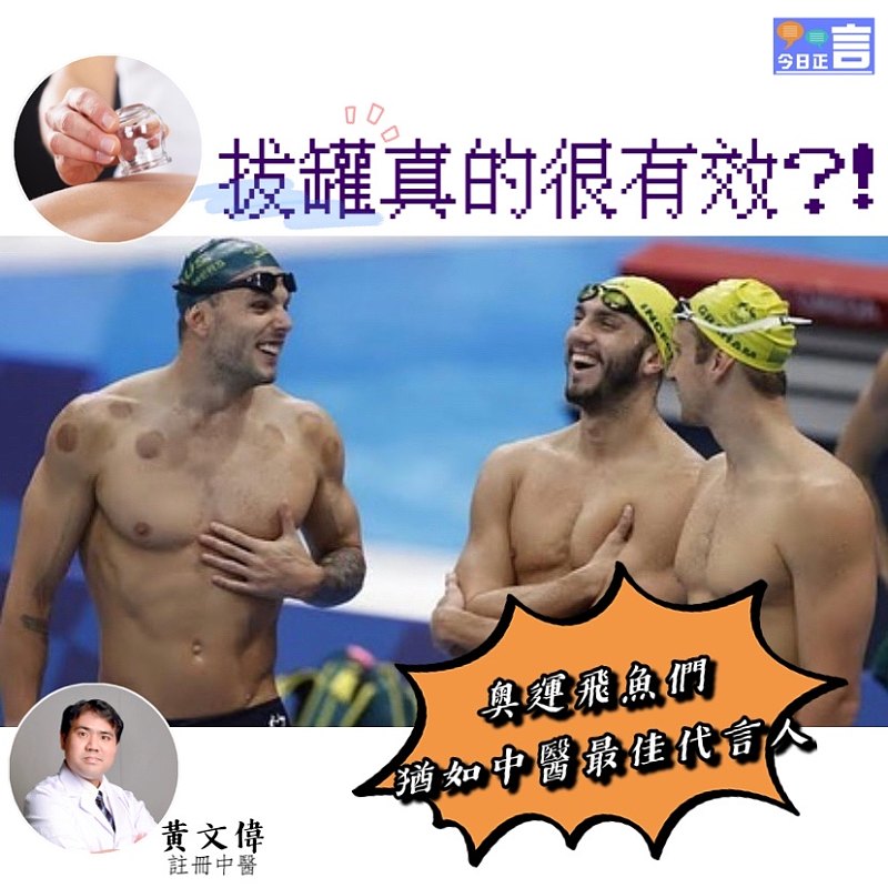 奧運與拔罐治療