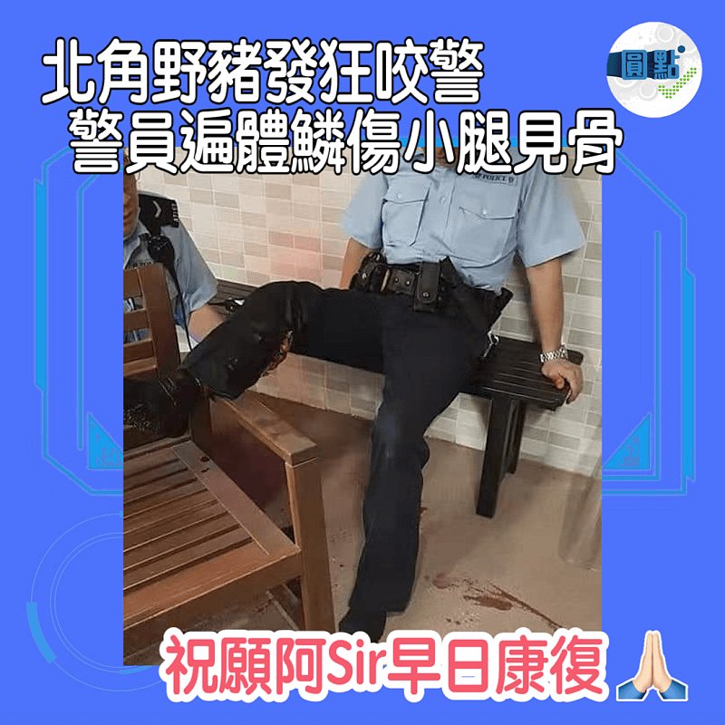 北角野豬發狂咬警 警員遍體鱗傷小腿見骨