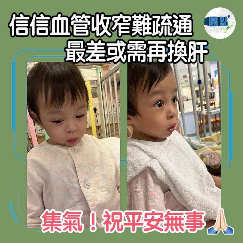 信信血管收窄無法疏通 嚴重會吐血最差或需再換肝