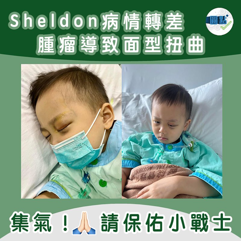 Sheldon病情轉差 腫瘤導致面型扭曲