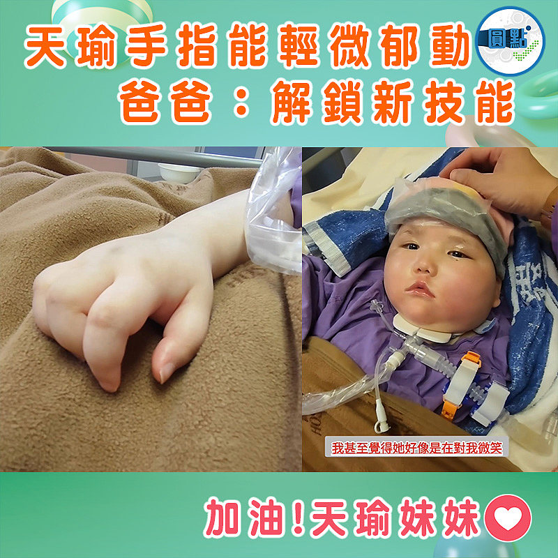 天瑜手指能輕微郁動 爸爸：解鎖新技能