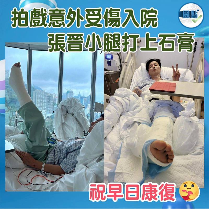 張晉拍戲意外受傷入院 小腿打上石膏