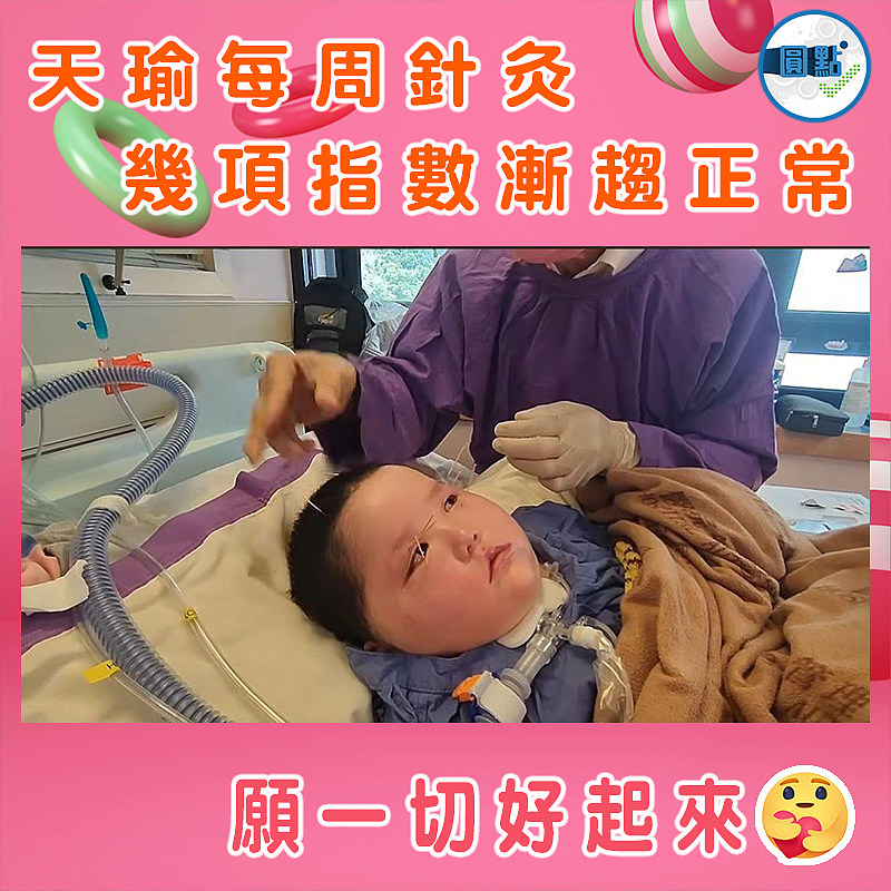 天瑜每周針灸 幾項指數漸趨正常