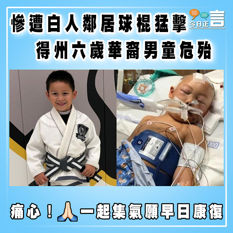 慘遭白人鄰居球棍猛擊  得州六歲華裔男童危殆