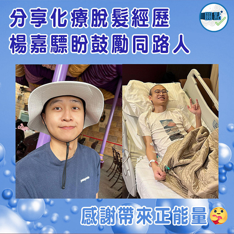分享化療脫髮經歷 楊嘉驃盼鼓勵同路人