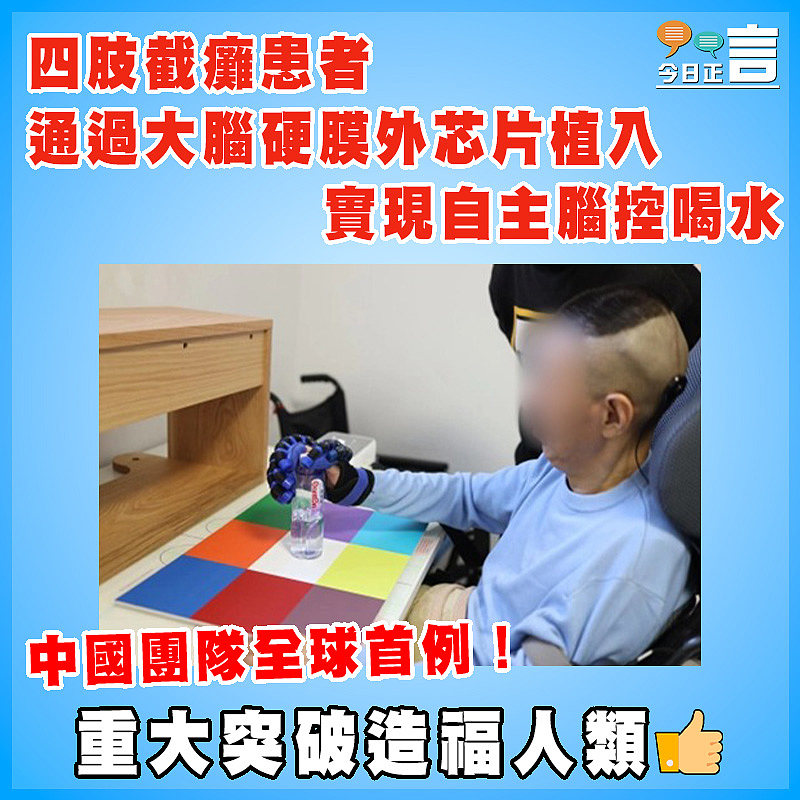 中國團隊全球首例！四肢截癱患者通過大腦硬膜外芯片植入實現自主腦控喝水