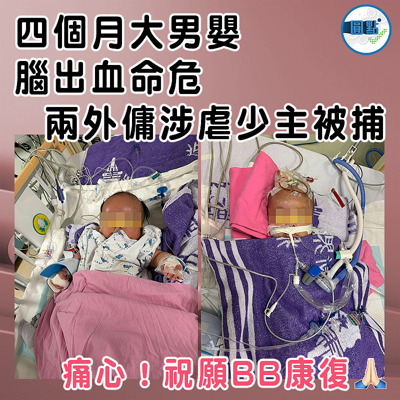 四個月大男嬰腦出血命危 兩外傭涉虐少主被捕