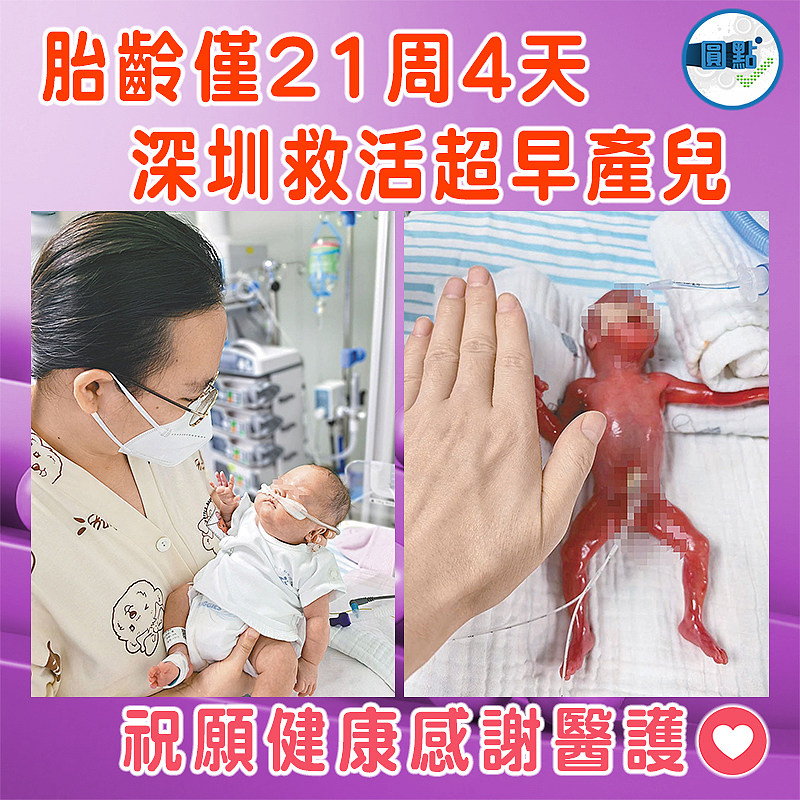 胎齡僅21周4天 深圳救活超早產兒