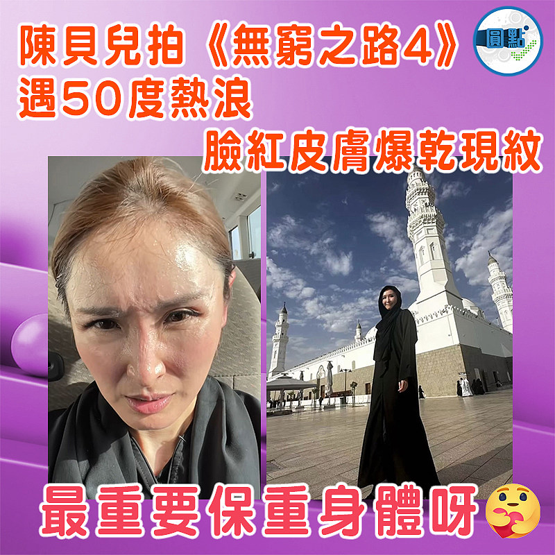 陳貝兒拍《無窮之路4》遇50度熱浪 臉紅皮膚爆乾現紋