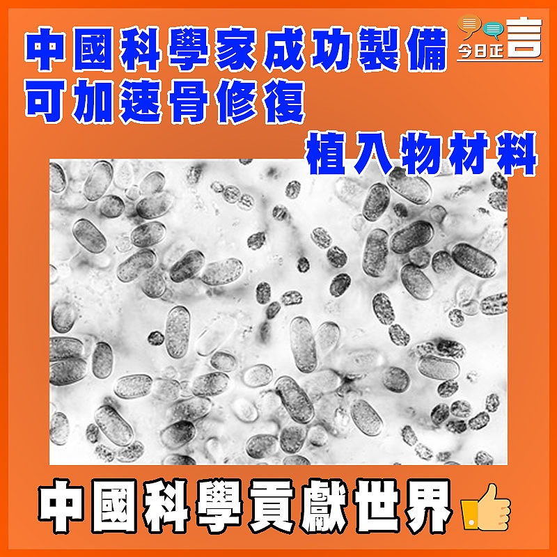 中國科學家成功製備可加速骨修復植入物材料