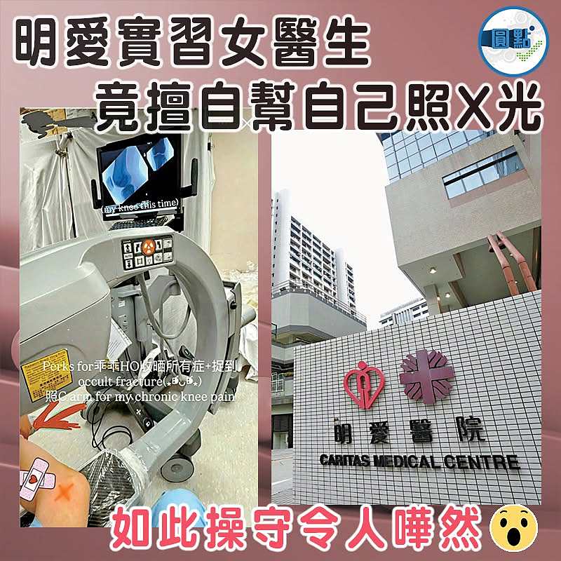 明愛實習女醫生竟擅自幫自己照X光