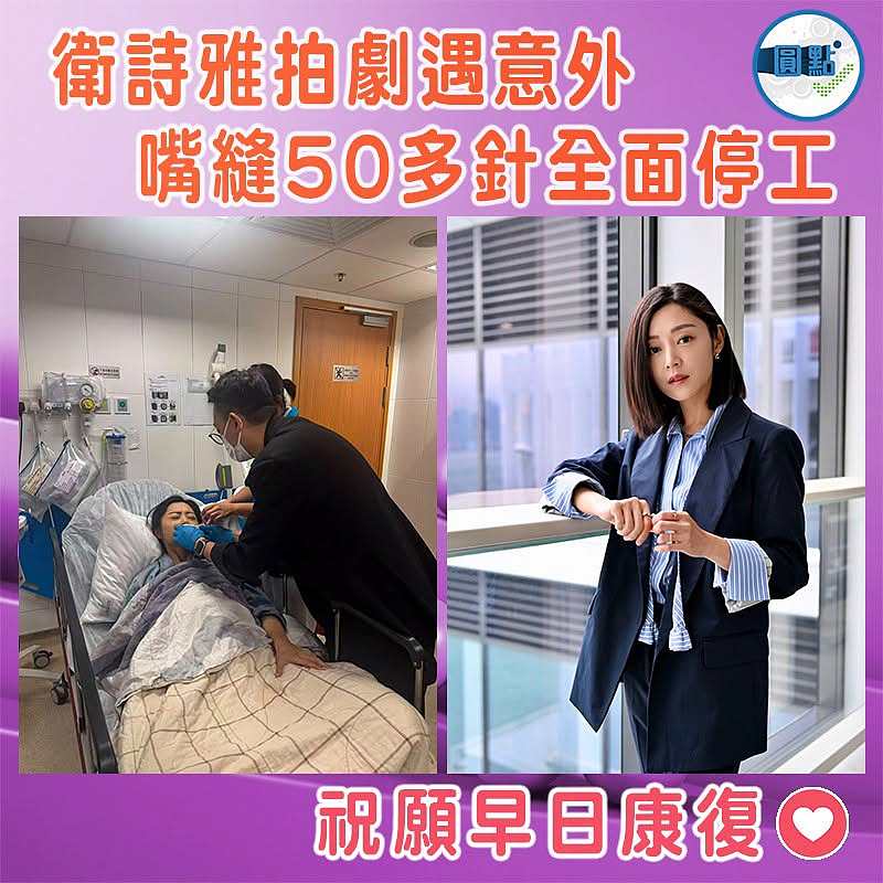 衛詩雅拍劇遇意外  嘴縫50多針全面停工